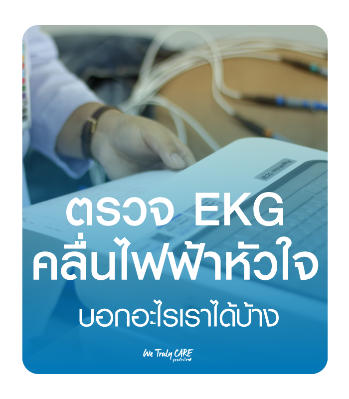 ตรวจคลื่นไฟฟ้าหัวใจ EKG บอกอะไรเราได้บ้าง