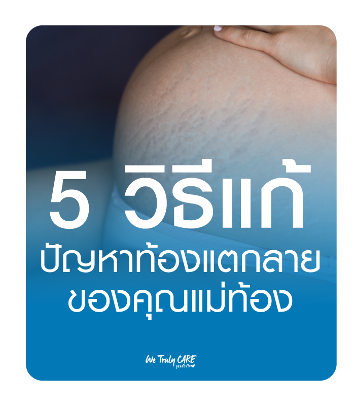 5 วิธีแก้ปัญหา ท้องแตกลายของคุณแม่ท้อง