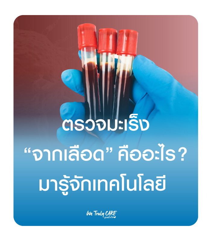 “ตรวจมะเร็งผ่านเลือด” คืออะไร? รู้จักเทคโนโลยีคัดกรองมะเร็งยุคใหม่